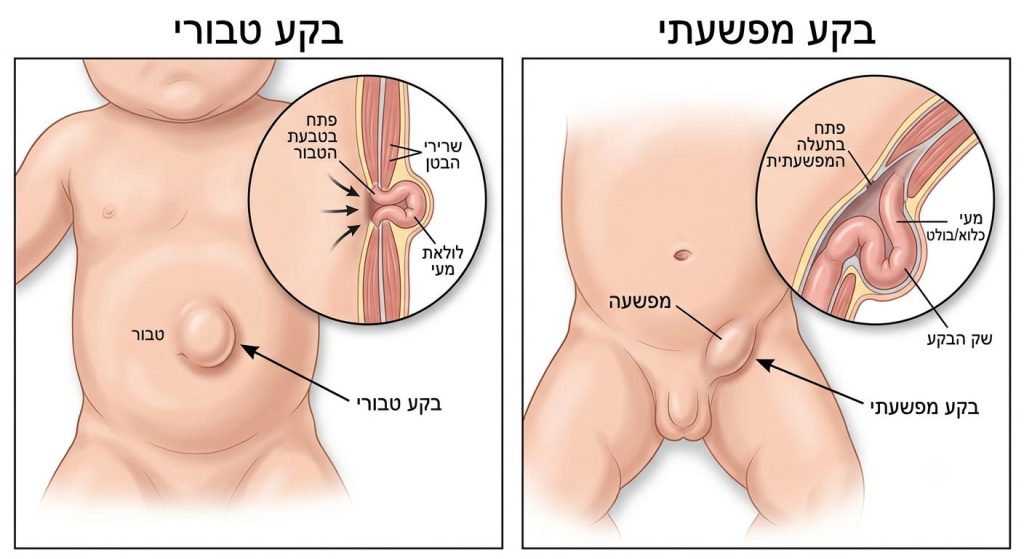 בקע אצל תינוקות