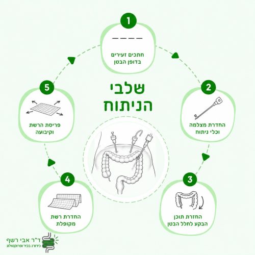 ניתוח בקע טבורי - ד״ר אבי רשף - פרוקטולוג וכירורג בכיר