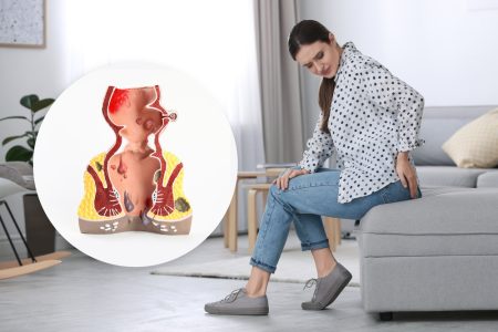 תרופות סבתא נגד כאבי טחורים